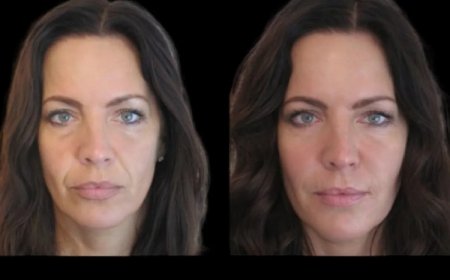 Best Plastic Surgeon in dubai for Jawline Fillers: How to Find the Best Clinic for Your Treatment