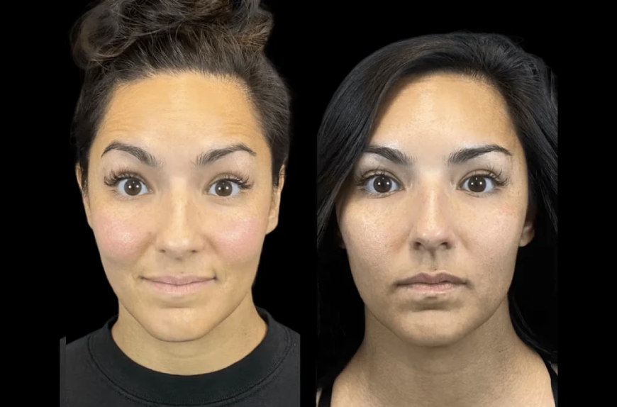 Get That Glow: Skin Rejuvenation at the Best Aesthetic Clinic in Dubai
