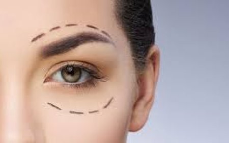 Upper Blepharoplasty in Jeddah: Rejuvenate Tired Eyes with Expert Eyelid Surgery