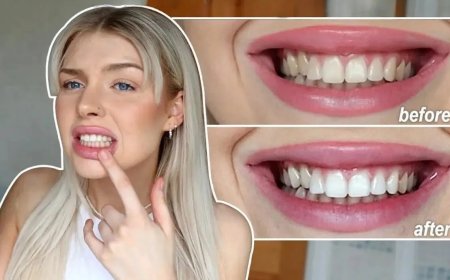 Crest 3D Whitening Strips UK by The White Smiles: Your Path to a Brighter Smile