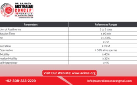 How to prepare for a semen analysis test