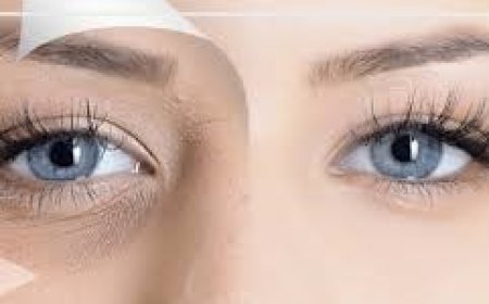 Reverse the Ages: Tried-and-True Under Eye Wrinkle Treatments for Youthful, Smooth Skin