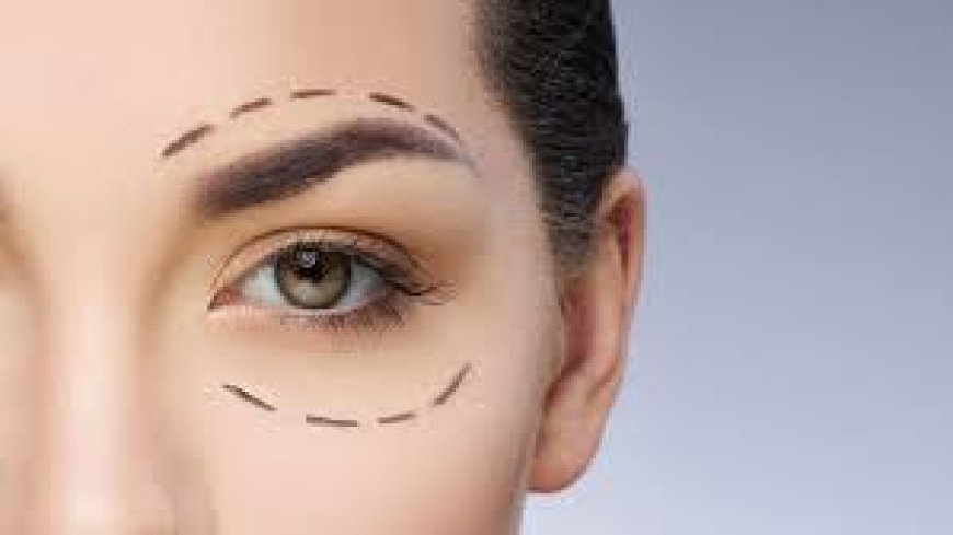 Upper Blepharoplasty in Jeddah: Rejuvenate Tired Eyes with Expert Eyelid Surgery