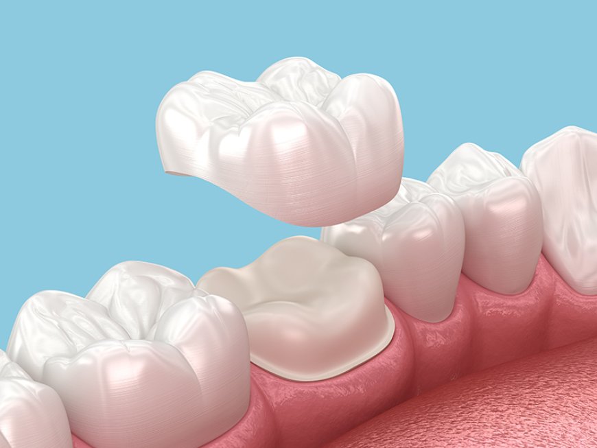 Dental Tooth Filling Dubai: Painless, Quick, and Long-Lasting Solutions