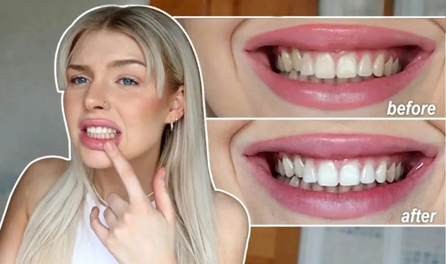 Crest 3D Whitening Strips UK by The White Smiles: Your Path to a Brighter Smile