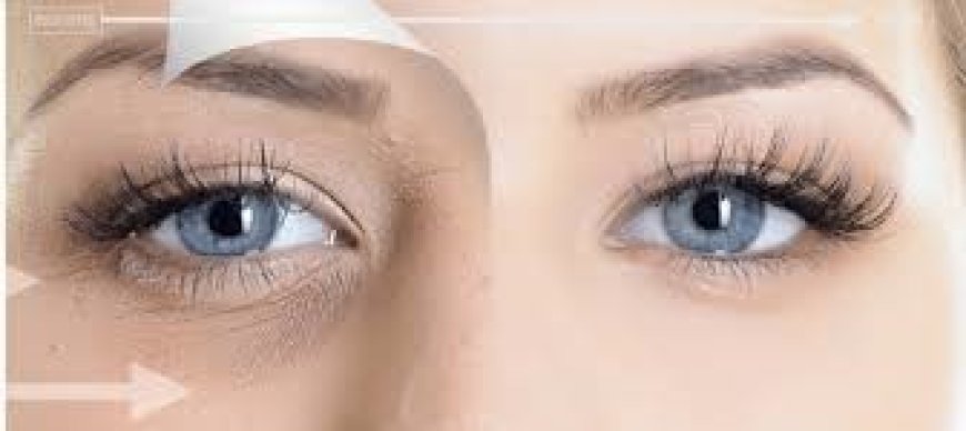 Reverse the Ages: Tried-and-True Under Eye Wrinkle Treatments for Youthful, Smooth Skin